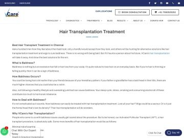 www.vcaretrichology.comhair transplantation treatment.php